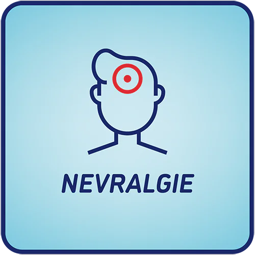 nevralgie